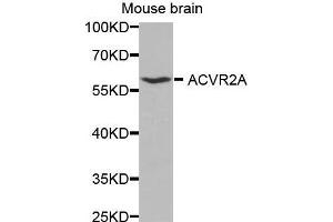 Western Blotting (WB) image for anti-Activin A Receptor, Type IIA (ACVR2A) (AA 20-140) antibody (ABIN3015792) (ACVR2A Antikörper  (AA 20-140))