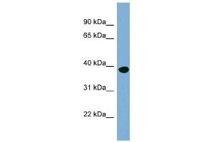 OAS1 antibody used at 1 ug/ml to detect target protein. (OAS1 Antikörper  (N-Term))