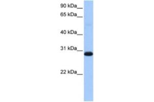 Western Blotting (WB) image for anti-Tryptophanyl tRNA Synthetase 2, Mitochondrial (WARS2) antibody (ABIN2463510) (WARS2 Antikörper)