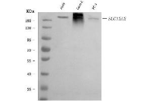 Western blot analysis of NKCC1/SLC12A2 using anti-NKCC1/SLC12A2 antibody (ABIN7602601).