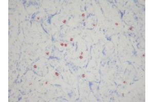 Immunohistochemistry (IHC) image for anti-CD16 (CD16) antibody (ABIN781725) (CD16 Antikörper)