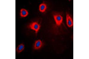 Immunofluorescent analysis of TPL2 (pT290) staining in HepG2 cells. (MAP3K8 Antikörper  (pSer290))