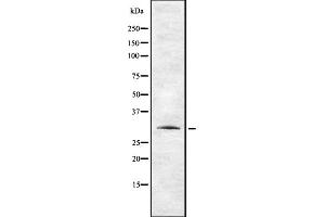 Western blot analysis of TAS2R12 using HepG2 whole cell lysates (TAS2R12 Antikörper)