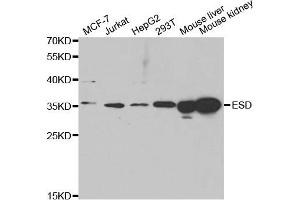 Western Blotting (WB) image for anti-Esterase D (ESD) antibody (ABIN1882355) (Esterase D Antikörper)
