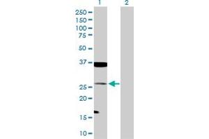 Western Blot analysis of TAGLN expression in transfected 293T cell line by TAGLN MaxPab polyclonal antibody. (Transgelin Antikörper  (AA 1-201))