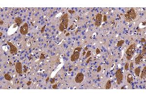 Immunohistochemistry (IHC) image for anti-Myelin Oligodendrocyte Glycoprotein (MOG) (AA 29-153) antibody (ABIN7429421)