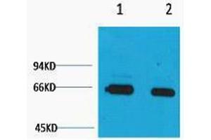 Western Blotting (WB) image for anti-Bovine Serum Albumin (BSA) antibody (ABIN3181294)
