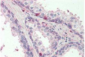 Human Prostate: Formalin-Fixed, Paraffin-Embedded (FFPE) (CCDC90A Antikörper  (AA 252-301))