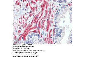 Immunohistochemistry with Human Prostate lysate tissue at an antibody concentration of 5. (SSX4 Antikörper  (Middle Region))