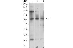 Western Blotting (WB) image for anti-ATG5 Autophagy Related 5 (ATG5) (AA 144-275) antibody (ABIN5611293)