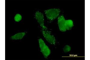 Immunofluorescence of monoclonal antibody to PCK1 on HepG2 cell. (PCK1 Antikörper  (AA 1-622))