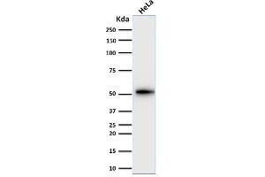 Western Blot Analysis of human HeLa cell lysate using Cytokeratin-7 Mouse Monoclonal Antibody (KRT7/2200). (Cytokeratin 7 Antikörper)