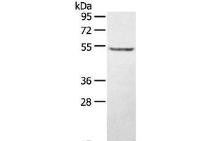 Western Blot analysis of A431 cell using STYK1 Polyclonal Antibody at dilution of 1:500 (STYK1 Antikörper)