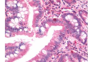 anti-Zinc Finger Homeobox 3 (ZFHX3) (AA 517-787) antibody