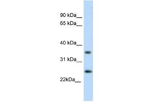 WB Suggested Anti-FADD Antibody Titration: 0. (FADD Antikörper  (C-Term))