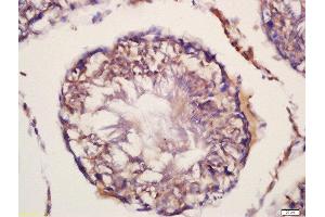 Formalin-fixed and paraffin embedded rat testis labeled with Rabbit Anti-FEM 1B Polyclonal Antibody, Unconjugated (ABIN873113) at 1:200 followed by conjugation to the secondary antibody and DAB staining (FEM1B Antikörper  (AA 531-627))