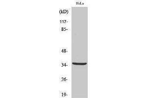Western Blotting (WB) image for anti-Cathepsin L2 (CTSL2) (cleaved), (Leu114) antibody (ABIN6284913) (Cathepsin L2 Antikörper  (cleaved, Leu114))