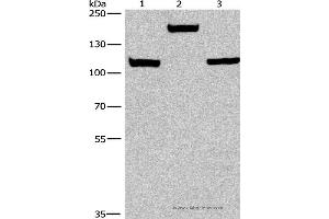 Western blot analysis of Mouse kidney tissue, 293T and 231 cell, using TP53BP2 Polyclonal Antibody at dilution of 1:375 (TP53BP2 Antikörper)