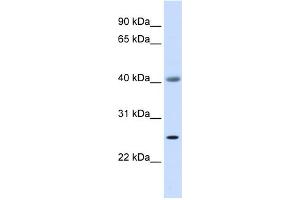 WB Suggested Anti-ADA Antibody Titration: 0. (ADA Antikörper  (Middle Region))