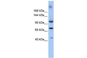 Western Blotting (WB) image for anti-Terminal Uridylyl Transferase 1, U6 SnRNA-Specific (TUT1) antibody (ABIN2458014) (TUT1 Antikörper)