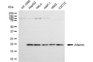 Western blotting analysis using artemin antibody (ABIN7797655).