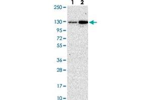 Western blot analysis of Lane 1: Human cell line RT-4 Lane 2: Human cell line U-251MG with CGNL1 polyclonal antibody  at 1:250-1:500 dilution. (CGNL1 Antikörper)