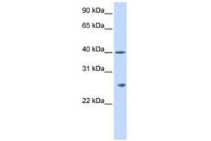 Image no. 1 for anti-Glutathione S-Transferase kappa 1 (GSTK1) (AA 36-85) antibody (ABIN6743827) (GSTK1 Antikörper  (AA 36-85))