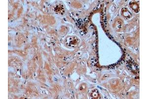 Detection of TUBb in Human Mammary gland Tissue using Monoclonal Antibody to Tubulin Beta (TUBb) (TUBB Antikörper  (AA 170-419))
