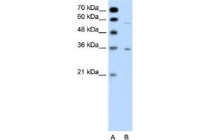 Western Blotting (WB) image for anti-G Protein-Coupled Receptor, Family C, Group 5, Member A (GPRC5A) antibody (ABIN2462428)