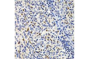 Immunohistochemistry of paraffin-embedded human lymphonodus using GEMIN2 Antibody. (SIP1 Antikörper)