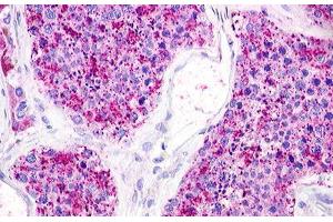Image no. 1 for anti-Lysophosphatidic Acid Receptor 5 (LPAR5) (C-Term) antibody (ABIN1049019) (LPAR5 Antikörper  (C-Term))