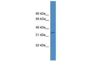 WB Suggested Anti-ELMOD1 Antibody Titration: 0. (ELMOD1 Antikörper  (Middle Region))