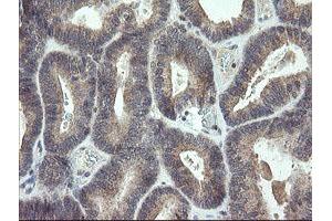 Image no. 2 for anti-Cyclin-Dependent Kinase Inhibitor 2B (p15, Inhibits CDK4) (CDKN2B) antibody (ABIN1497445) (CDKN2B Antikörper)