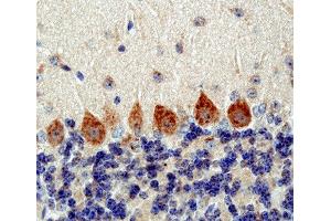 Immunohistochemistry (Paraffin-embedded Sections) (IHC (p)) image for anti-Vesicle Transport through Interaction with T-SNAREs Homolog 1B (VTI1B) (AA 1-206) antibody (ABIN1742350)