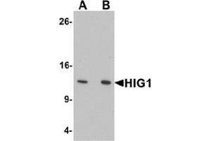 Western blot analysis of HIG1 in 293 cell lysate with HIG1 Antibody  at at (A) 0.