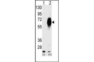 Western blot analysis of AMHR2 (arrow) using AMHR2 Antibody (AMHR2 Antikörper  (N-Term))