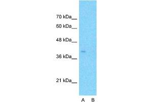 Host:  Rabbit  Target Name:  APOBEC3B  Sample Type:  HepG2  Lane A:  Primary Antibody  Lane B:  Primary Antibody + Blocking Peptide  Primary Antibody Concentration:  1ug/ml  Peptide Concentration:  5ug/ml  Lysate Quantity:  25ug/lane/lane  Gel Concentration:  0. (APOBEC3B Antikörper  (N-Term))