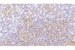 Detection of SDHB in Mouse Kidney Tissue using Polyclonal Antibody to Succinate Dehydrogenase Complex Subunit B (SDHB)
