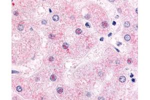 Immunohistochemistry (IHC) image for anti-Nuclear Receptor Subfamily 0, Group B, Member 2 (NR0B2) (Ligand Binding Domain) antibody (ABIN1049128)