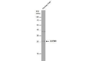 WB Image Human tissue extract (30 μg) was separated by 12% SDS-PAGE, and the membrane was blotted with GSTM1 antibody , diluted at 1:1000. (GSTM1 Antikörper)