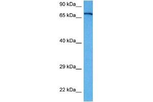 Host:  Rabbit  Target Name:  APP  Sample Tissue:  Human A172 Whole Cell lysates  Antibody Dilution:  1ug/ml (APP Antikörper  (Middle Region))