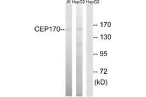 Western blot analysis of extracts from HepG2/Jurkat cells, using CEP170 Antibody.