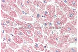 Rabbit Anti-RNH1 Antibody Catalog Number: ARP72880 Formalin Fixed Paraffin Embedded Tissue: Human Adult Heart  Observed Staining: Cytoplasm in hepatocytes Primary Antibody Concentration: 1:600 Secondary Antibody: Donkey anti-Rabbit-Cy3 Secondary Antibody Concentration: 1:200 Magnification: 20X Exposure Time: 0. (RNH1 Antikörper  (N-Term))