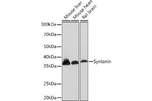 Western blot analysis of extracts of various cell lines, using Syntenin Rabbit mAb (ABIN7270680) at 1:1000 dilution. (SDCBP Antikörper)
