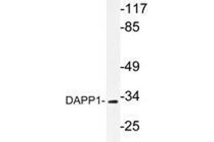 Western blot analysis of DAPP1 antibody in extracts from 293 cells. (DAPP1 Antikörper)