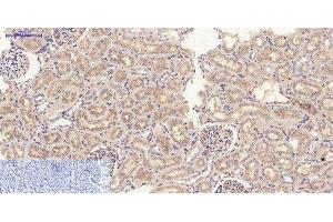 Immunohistochemistry of paraffin-embedded Rat kidney tissue using JAK2 Polyclonal Antibody at dilution of 1:200. (JAK2 Antikörper)