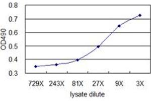 Standard curve using TAGLN 293T overexpression lysate (non-denatured) as an analyte.
