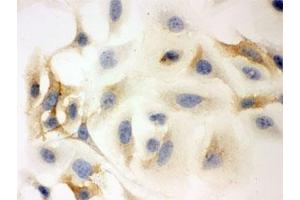 ICC testing of HeLa cells with HLA-C antibody. (HLA-C Antikörper)