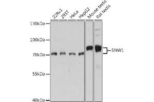 Western blot analysis of extracts of various cell lines, using SNW1 antibody (ABIN7270386) at 1:1000 dilution.
