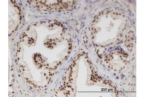Immunoperoxidase of monoclonal antibody to NUPL1 on formalin-fixed paraffin-embedded human prostate. (NUPL1 Antikörper  (AA 323-422))